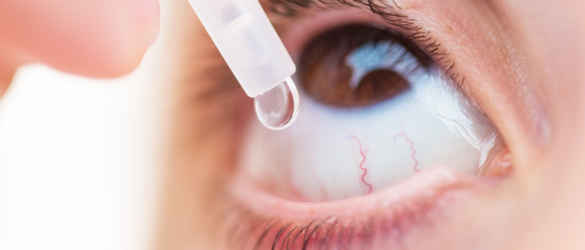 Eye drop being instilled into eye.